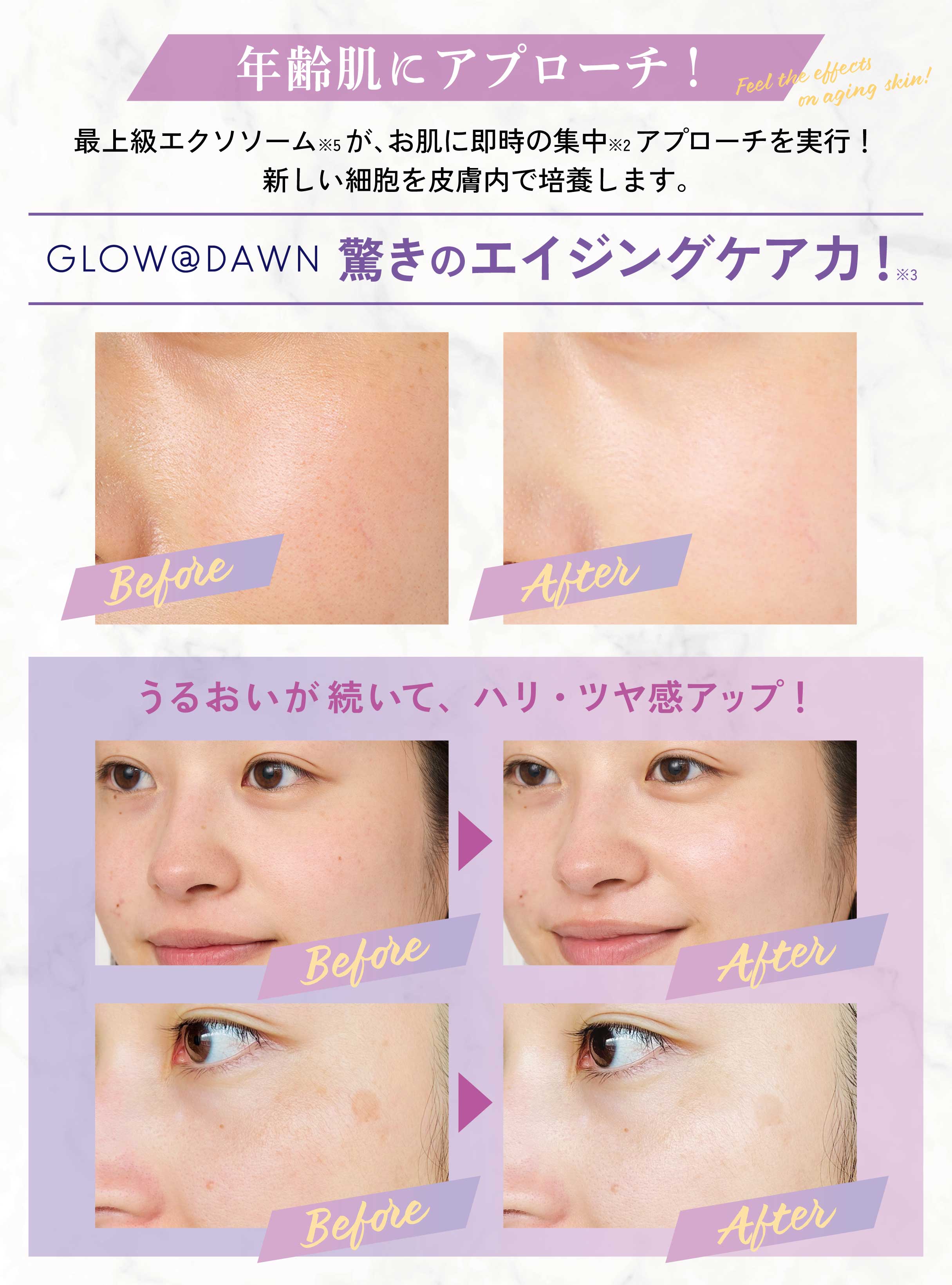 ビタミンC美容液｜GLOW@DAWN VCセラム 30mL｜エクソソーム配合｜宮城